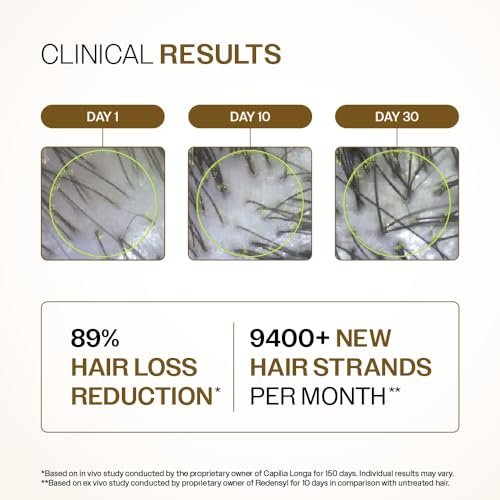 Bare Anatomy Advanced Hair Growth Serum| 3% Redensyl - 2x Better Results than Minoxidil | + 4% Anagain + 3% Baicapil | Rosemary, Biotin | Hair growth & Hair fall control serum for Women & Men | 30mL : Beauty & Personal Care - Image 4